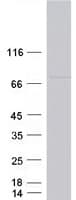 Human CCDC93 Protein (Recombinant Myc-DDK (Flag))