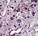 CMPK / CMPK1 Antibody (aa18-48)