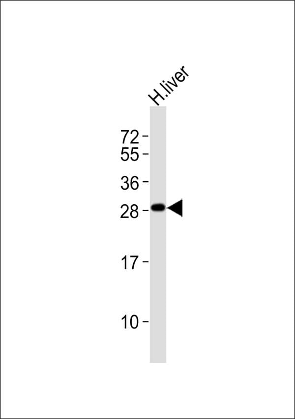 GSTM1 Antibody