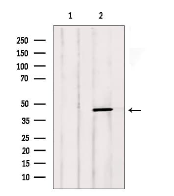 LTBR Antibody