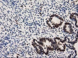 NMNAT1 / NMNAT Antibody (clone OTI1G4)