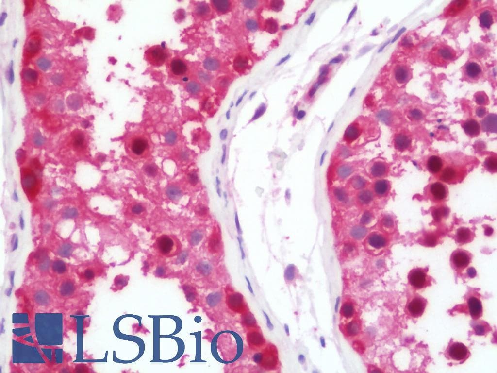 IHC-plus™ Polyclonal Rabbit anti-Human CCT5 / TCP1 Epsilon Antibody (aa89-338, IHC, WB)