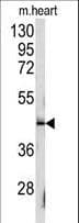 SLAMF1 / SLAM / CD150 Antibody (Tyr307)
