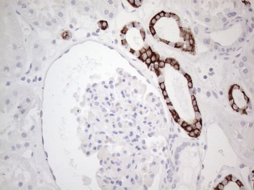 Monoclonal Mouse anti-Human KRT19 / CK19 / Cytokeratin 19 Antibody (clone UMAB188, aa240-390, IHC, IF, WB)