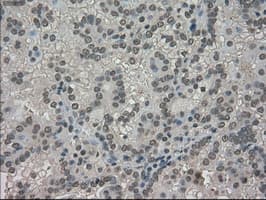 TRIB2 Antibody (clone OTI8D11)