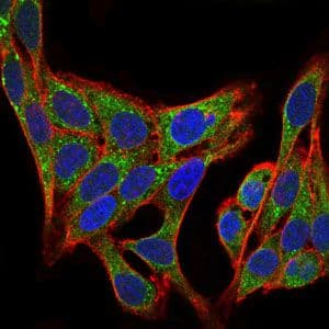 Monoclonal Mouse anti-Human PIK3R1 / p85 Alpha Antibody (clone 6G10, Amino Acid: 159-388, IHC, IF, WB)