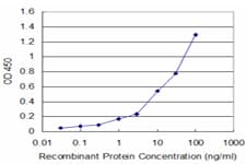 Monoclonal Mouse anti-Human P2RX5 / P2X5 Antibody (clone 1C5, WB)