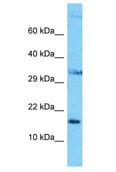 NUDCD2 Antibody (aa108-157)