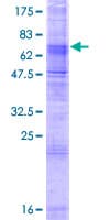 Human SLC24A5 / NCKX5 Protein (Recombinant GST)