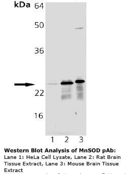 IHC-plus™ Polyclonal Rabbit anti-Rat SOD2 / Mn SOD Antibody (IHC, WB)