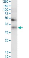 Monoclonal Mouse anti-Human TF / Transferrin Antibody (clone 1C2, IF, WB)