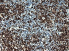 Monoclonal Mouse anti-Human CD2 Antibody (clone UMAB6, Carrier-free, IHC, IF, WB)