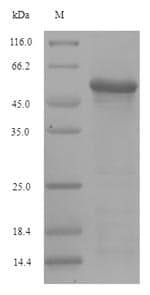 Influenza A Virus Hemagglutinin Protein (Recombinant 6His-SUMO, N-terminus)