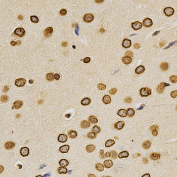 LMNA / Lamin A+C Antibody