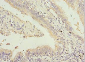 GABRR1 / GABA(A) Receptor rho- Antibody