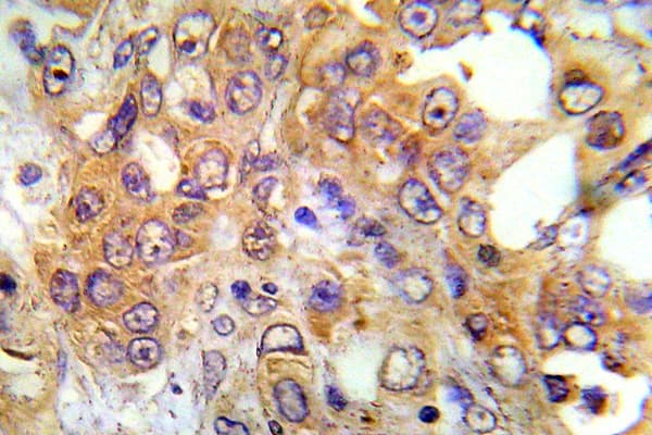 Polyclonal Rabbit anti-Human PRKAA1 / AMPK Alpha 1 Antibody (Asn180, IHC, WB)