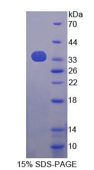 Human APPL1 / APPL Protein (Recombinant His-T7)