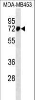ZNF326 / Zfp326 Antibody (aa127-155)