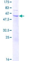 Human SDR39U1 Protein (Recombinant GST)