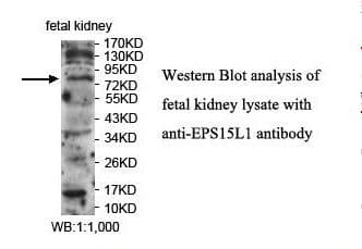 EPS15L1 / EPS15R Antibody (aa327-484)