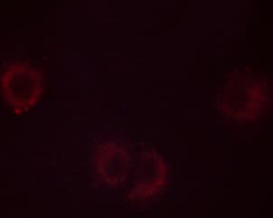 PLA2G4A Antibody (phospho-Ser505)