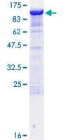 Human DLG3 / SAP102 Protein (Recombinant GST)