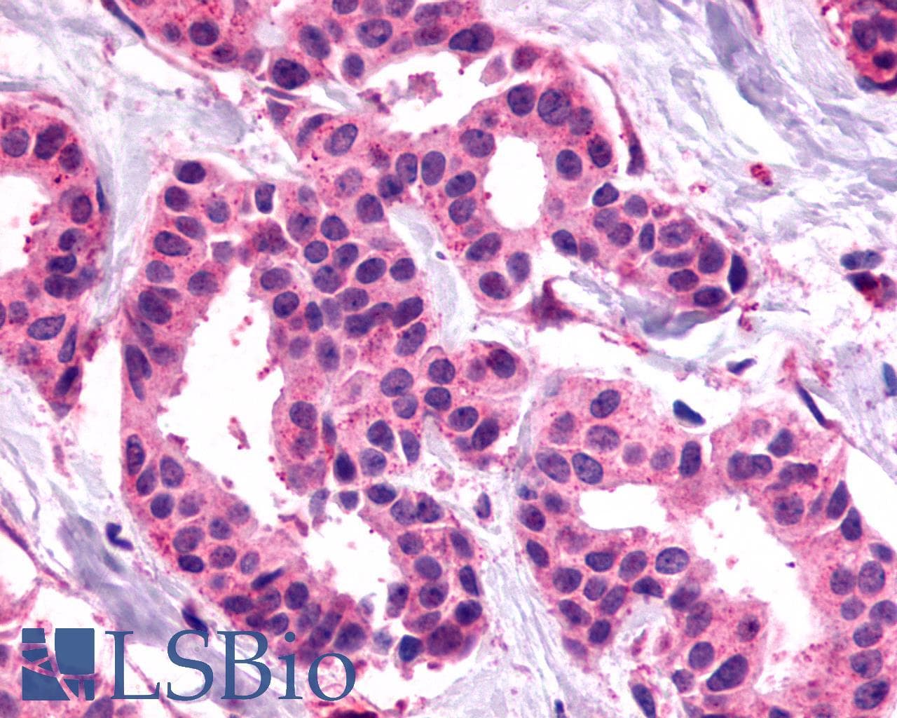 PathPlus™ Polyclonal Rabbit anti-Human SSTR1 Antibody (C-Terminus, IHC)