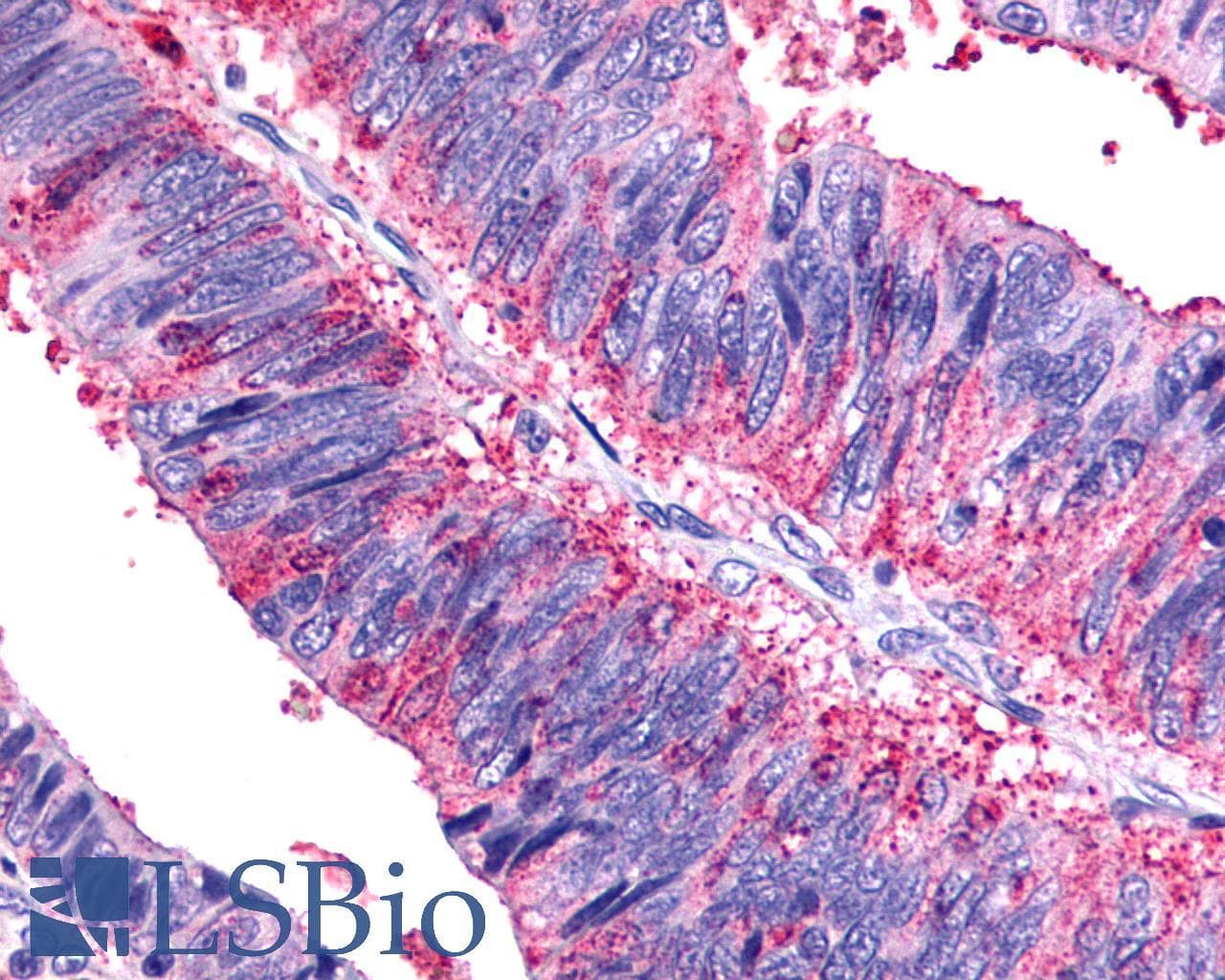 PathPlus™ SSTR1 Antibody (N-Terminus)