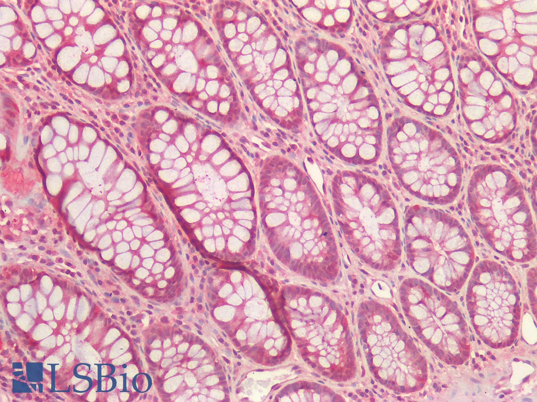 OTUB1 / OTU1 Antibody (clone AT17E10)