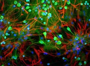 IHC-plus™ Polyclonal Chicken anti-Human UCHL1 / PGP9.5 Antibody (IHC, IF, WB)