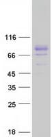 Human TBKBP1 Protein (Recombinant Myc-DDK (Flag))