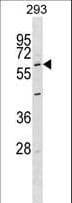 PAEL Receptor / GPR37 Antibody (aa97-126)