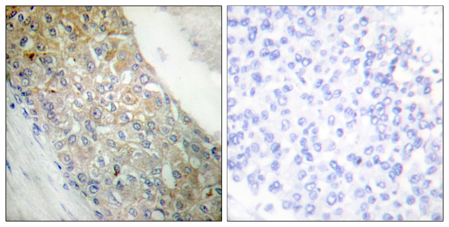 INSR / Insulin Receptor Antibody (aa1326-1375)