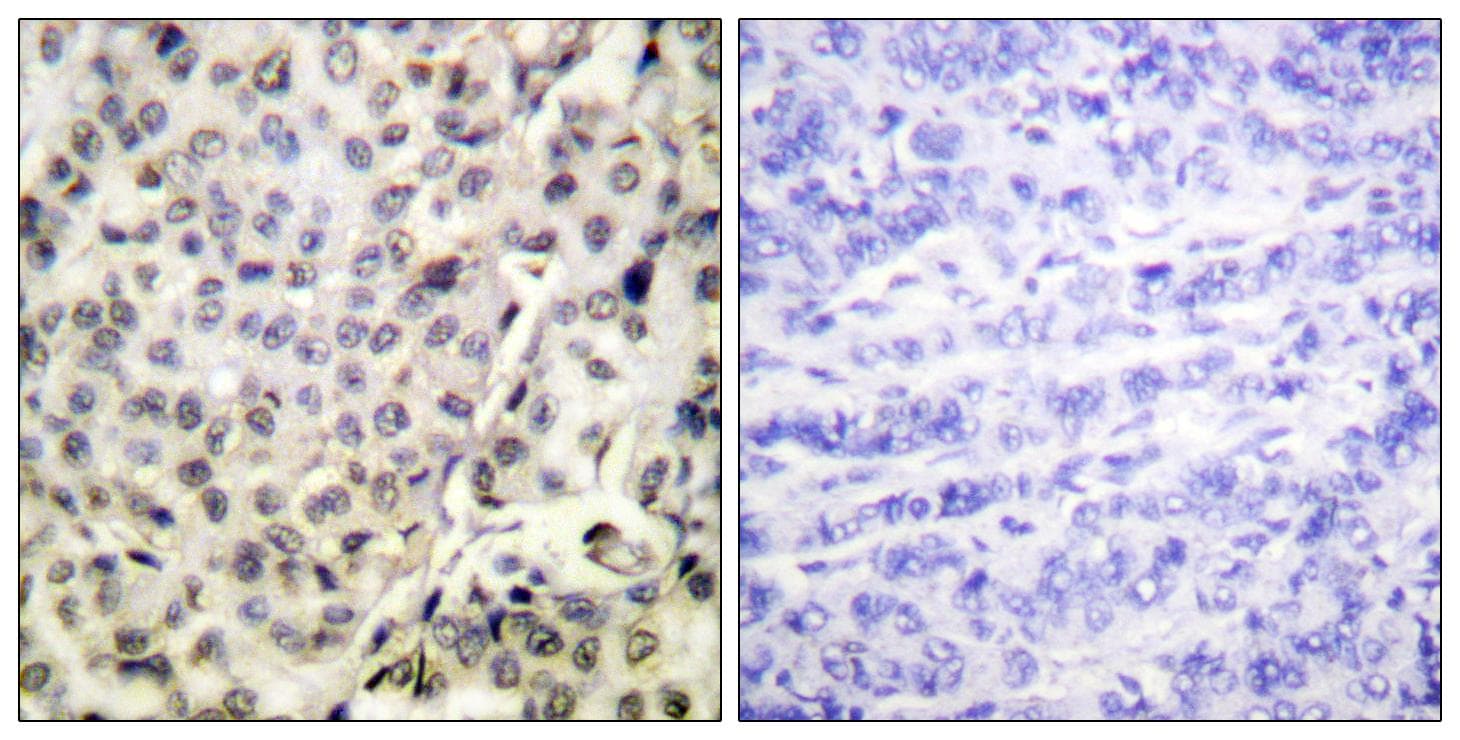 APC6 / CDC16 Antibody (p560)