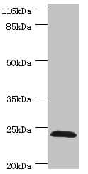 Polyclonal Rabbit anti-Human GSTZ1 Antibody (IHC, WB)
