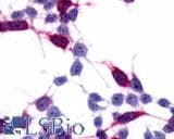 PathPlus™ Polyclonal Rabbit anti-Human FZD6 / Frizzled 6 Antibody (N-Terminus, IHC)