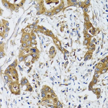 BLZF1 Antibody