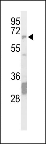 PTPN5 / STEP Antibody (aa168-198)