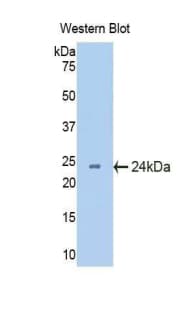 CRYBB2 Antibody (aa17-191, APC, Cy7)