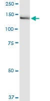 IGSF1 Antibody (clone 4C7)