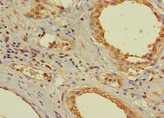Polyclonal Rabbit anti-Human AR / Androgen Receptor Antibody (IHC)