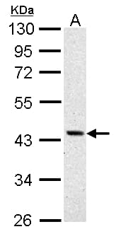 ASS1 / ASS Antibody (aa1-198)