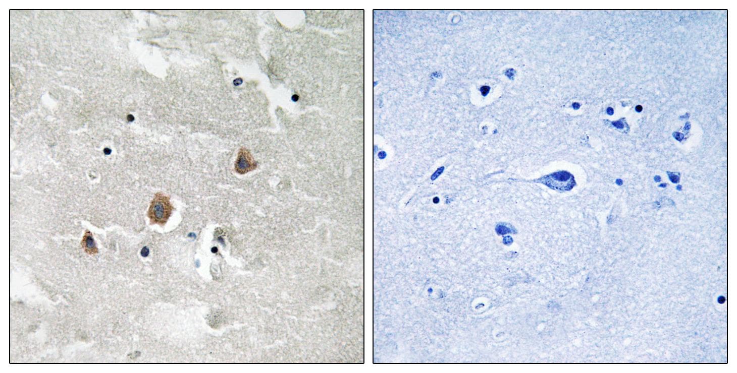 MAP3K1 / MEKK1 Antibody (phospho-Thr1402)
