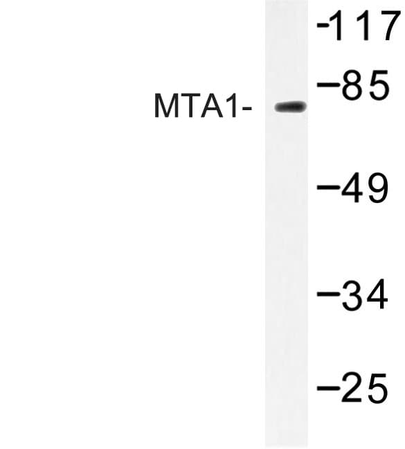 MTA1 Antibody (Lys182)