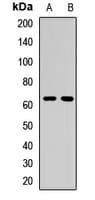 ALAS2 Antibody