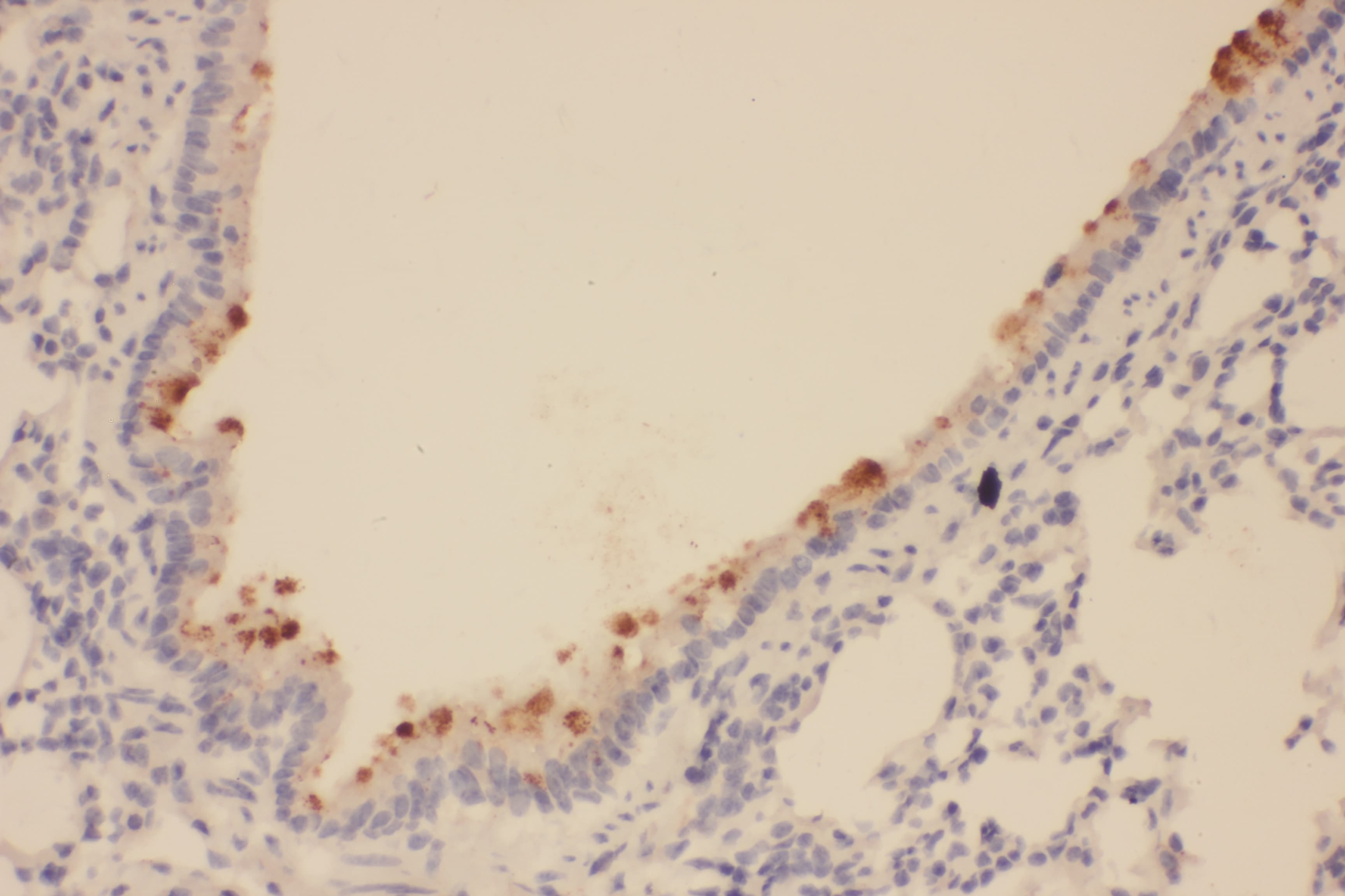 SOX2 Antibody (aa171-183)