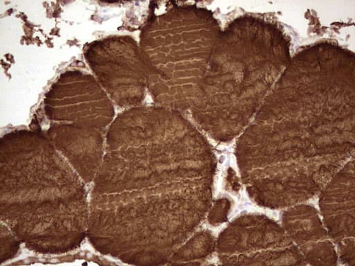 TG / Thyroglobulin Antibody (aa20-358, clone OTI8D5)