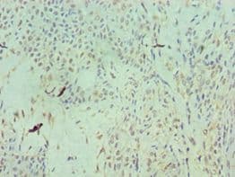 Polyclonal Rabbit anti-Human RAN Antibody (aa1-216, IHC, WB)