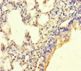 Polyclonal Rabbit anti-Human POMK / SGK196 Antibody