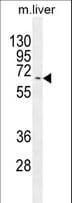 Polyclonal Rabbit anti-Human KY Antibody (aa104-133, WB)